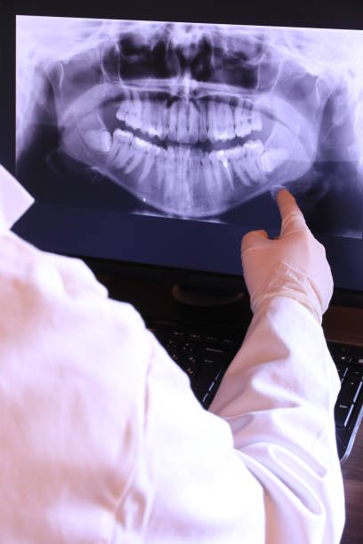 Best Emergency Tooth Extraction in Bartlesville, OK