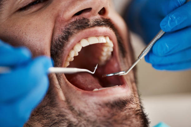 Best Emergency Treatment for Dental Infections or Abscesses in Bartlesville, OK