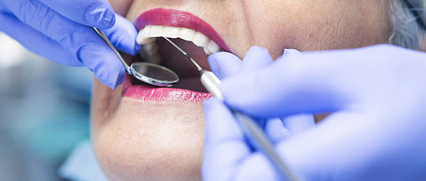 Best Emergency Dental Care for Broken or Chipped Teeth in Bartlesville, OK